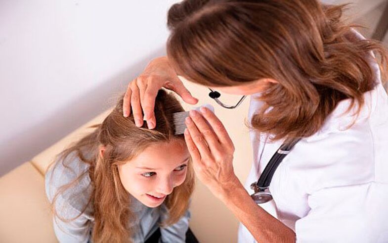 zdravljenje psoriaze glave pri otrocih