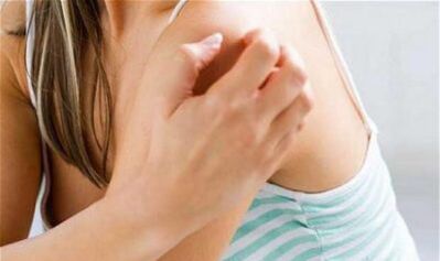 dekle, ki se praska po rami